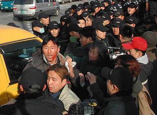 이날 범대위측은 경찰과의 몸싸움 과정에서 부상자가 속출했다 